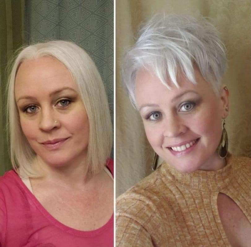 Was denken Sie über diese Haartransformation?